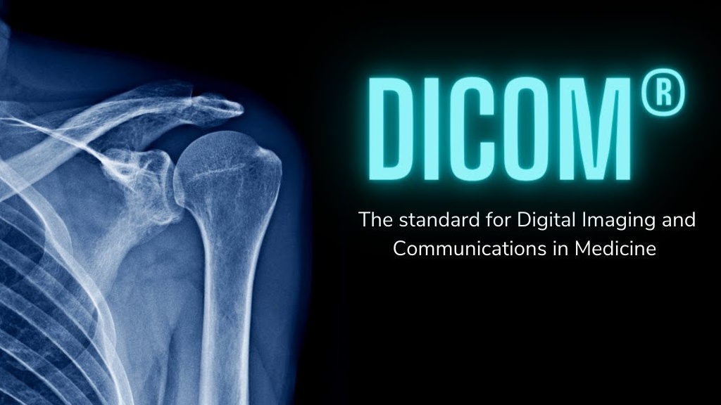 ثغرة خطيرة في نظام DICOM تسمح بتضمين أكواد ضارة ضمن ملفات الصور الطبية